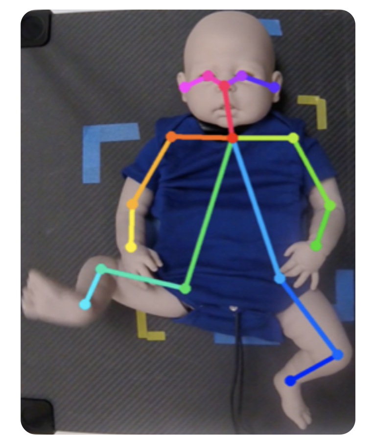 Robotics for Early Neuromotor Assessment
