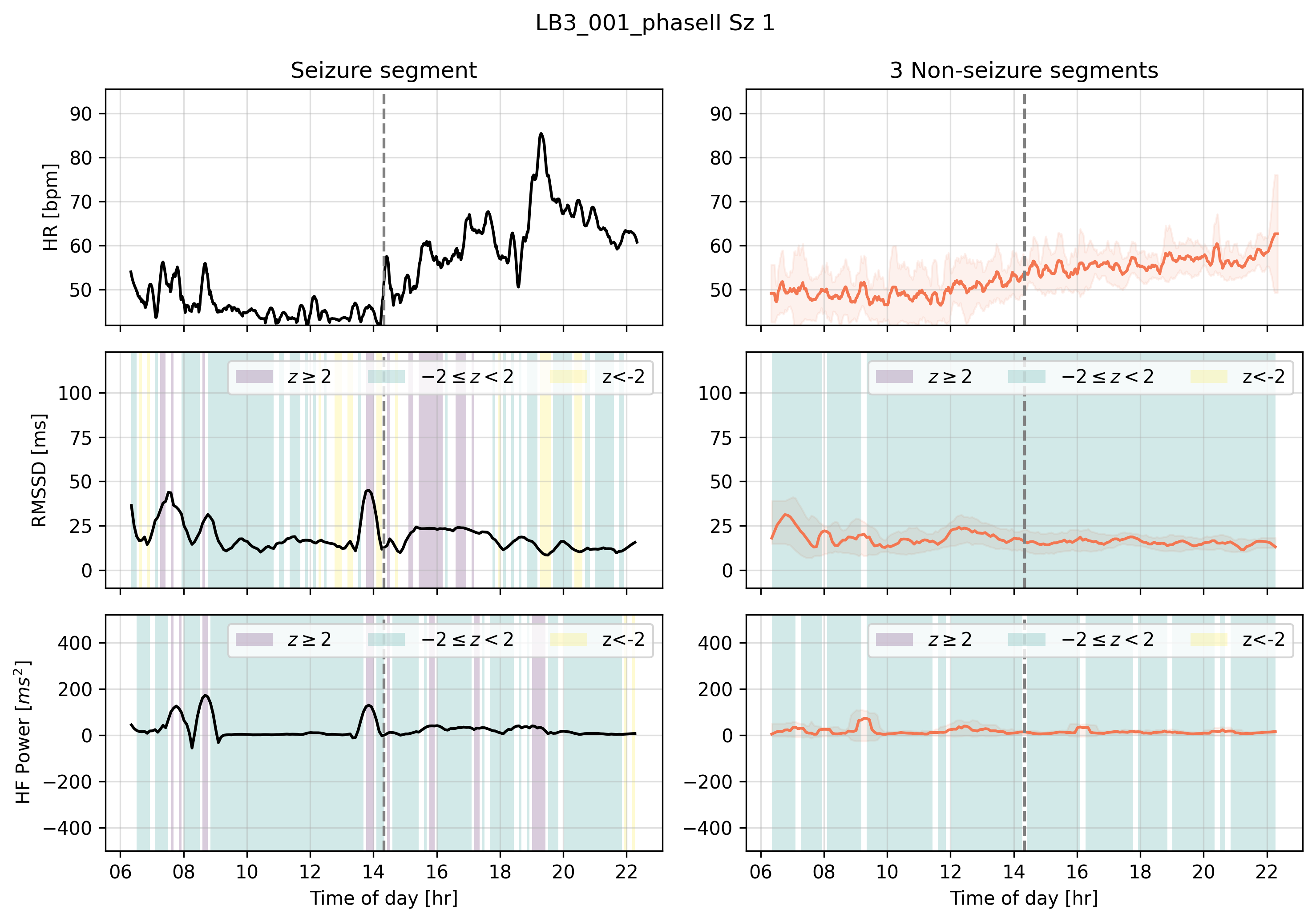 HRV states around seizure